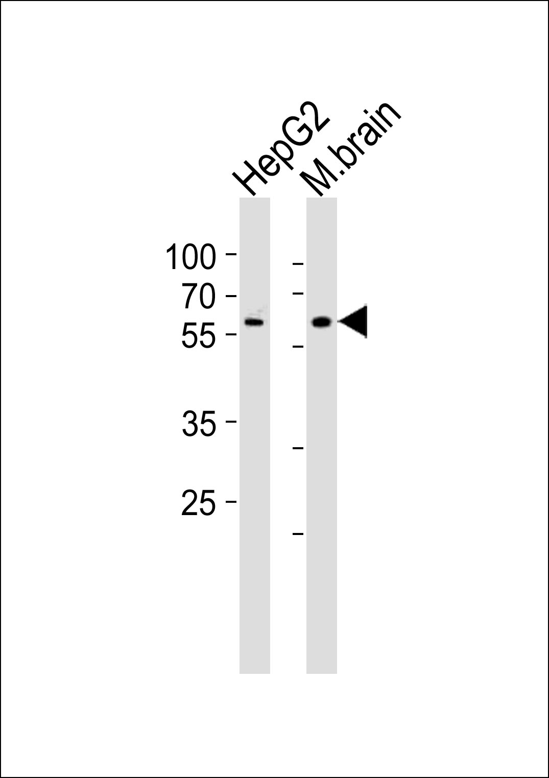 WB - GLD2 Antibody (N-term) AP5092a